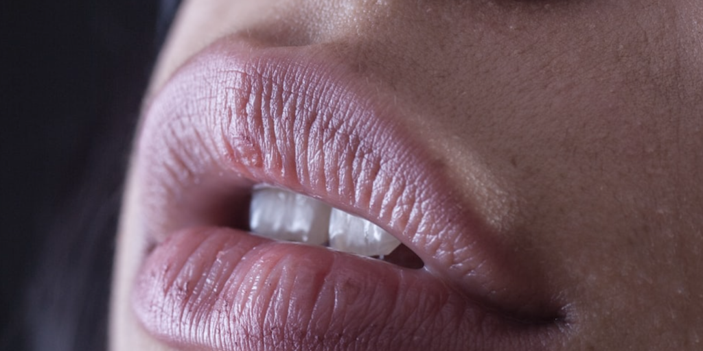 how-long-does-swelling-last-after-lip-filler-here-s-how-to-soothe