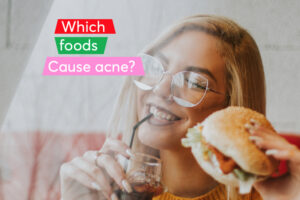 Foods Cause Acne